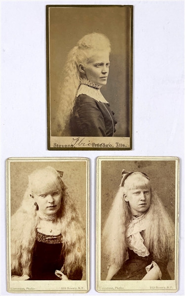 Trio of 19th Century Albino “Freak Show” Cabinet Photos Including The Martin Sisters-”Barnums Albino Beauties!”